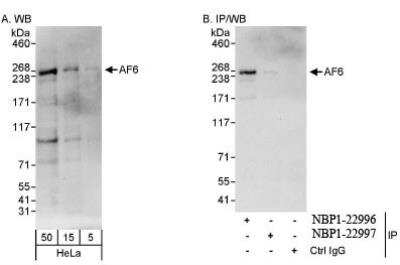 Western Blot: Afadin/AF-6 Antibody [NBP1-22996]