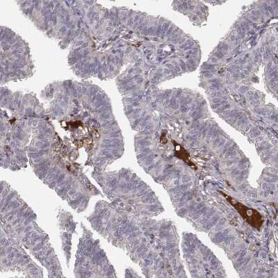 Immunohistochemistry: Afamin Antibody [NBP2-68702]