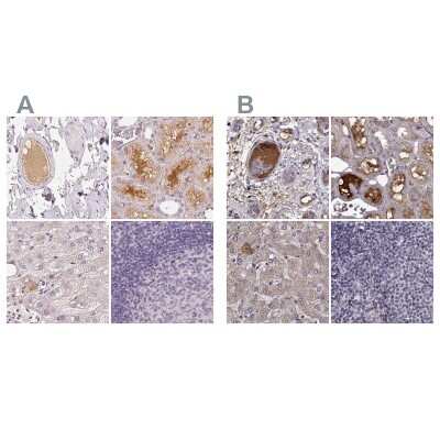 Immunohistochemistry-Paraffin: Afamin Antibody [NBP1-89156]