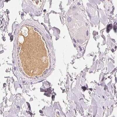 Immunohistochemistry-Paraffin: Afamin Antibody [NBP1-89156]