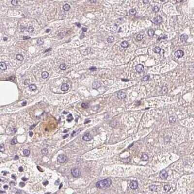 Immunohistochemistry-Paraffin: Afamin Antibody [NBP1-89156]