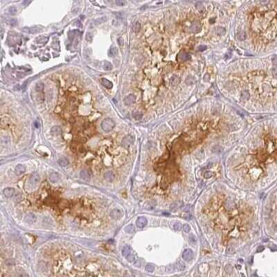 Immunohistochemistry-Paraffin: Afamin Antibody [NBP1-89156]