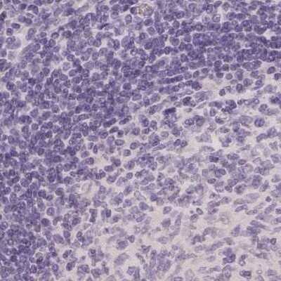 Immunohistochemistry-Paraffin: Afamin Antibody [NBP1-89156]