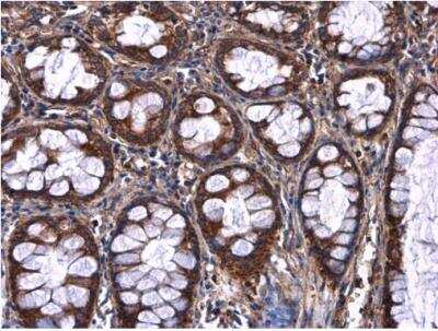 Immunohistochemistry-Paraffin: Afamin Antibody [NBP2-15304]