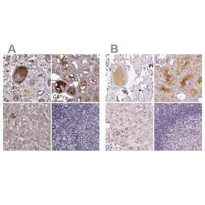 Immunohistochemistry-Paraffin: Afamin Antibody [NBP2-68702]