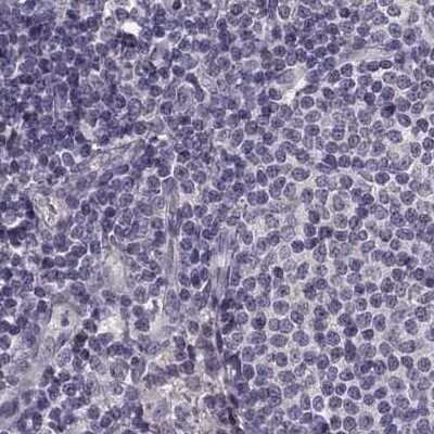 Immunohistochemistry-Paraffin: Afamin Antibody [NBP2-68702]