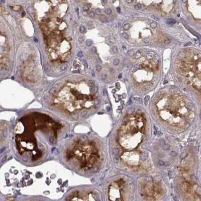 Immunohistochemistry-Paraffin: Afamin Antibody [NBP2-68702]