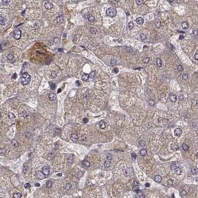 Immunohistochemistry-Paraffin: Afamin Antibody [NBP2-68702]