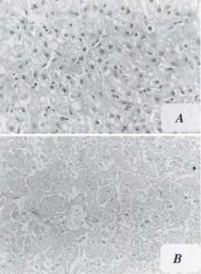 Immunohistochemistry: Aflatoxin B1 Antibody (6A10) - Azide and BSA Free [NBP2-80563]