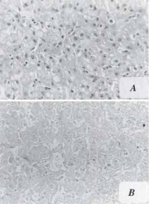 Immunohistochemistry: Aflatoxin B1 Antibody (6A10) - BSA Free [NB600-443]