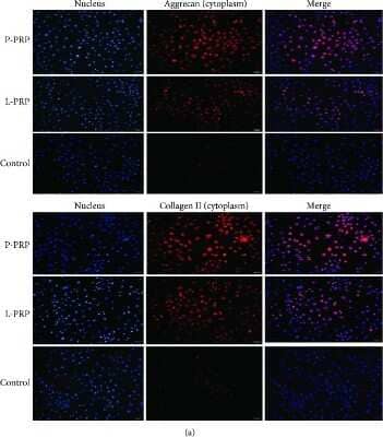 Immunocytochemistry/ Immunofluorescence: Aggrecan Antibody (BC-3) - BSA Free [NB600-504]