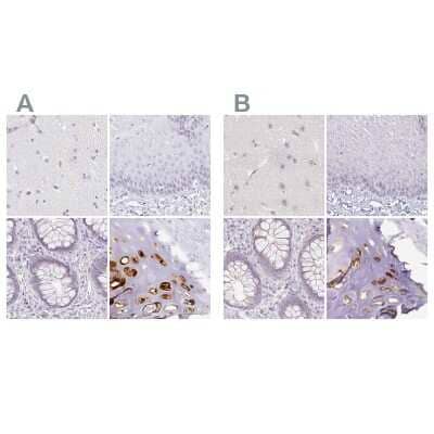 Immunohistochemistry-Paraffin: Aggrecan Antibody [NBP2-55539]