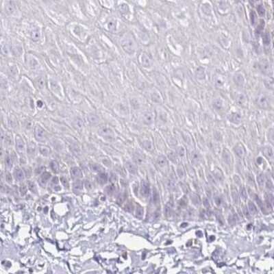 Immunohistochemistry-Paraffin: Aggrecan Antibody [NBP2-55540]