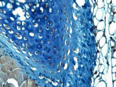 Immunohistochemistry: Aggrecan Neoepitope Antibody - BSA Free [NB100-74350]