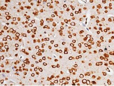 Immunohistochemistry-Paraffin: Ago2/eIF2C2 Antibody (036) [NBP2-90675]