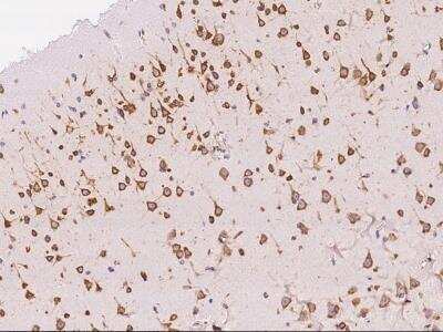 Immunohistochemistry-Paraffin: Ago2/eIF2C2 Antibody (036) [NBP2-90675]