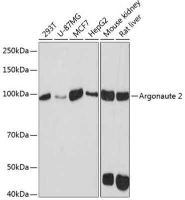 Western Blot: Ago2/eIF2C2 Antibody (10S10L5) [NBP3-15873]