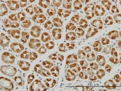 Immunohistochemistry-Paraffin: Ago2/eIF2C2 Antibody (2E12-1C9) [H00027161-M01]
