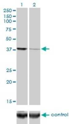 Western Blot: Ago2/eIF2C2 Antibody (2E12-1C9) [H00027161-M01]