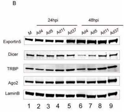 Western Blot: Ago2/eIF2C2 Antibody (2E12-1C9) [H00027161-M01]