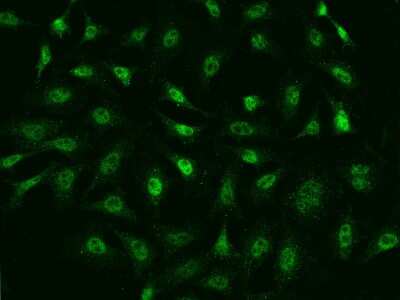 Immunocytochemistry/ Immunofluorescence: Ago2/eIF2C2 Antibody [NBP2-99647]