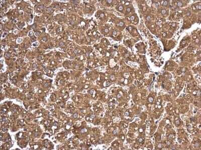 Immunohistochemistry-Paraffin: Ago2/eIF2C2 Antibody [NBP3-13024]