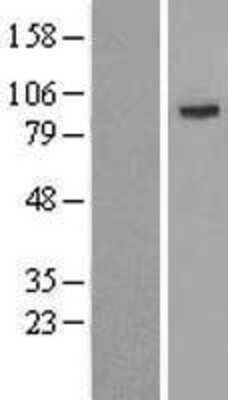 Western Blot: Ago2/eIF2C2 Overexpression Lysate [NBL1-10183]