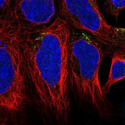 Immunocytochemistry/ Immunofluorescence: Agpat4 Antibody [NBP2-56652]