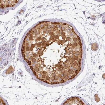 Immunohistochemistry-Paraffin: Agpat4 Antibody [NBP2-30948]