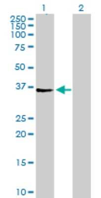 Western Blot: Agpat4 Antibody [H00056895-B01P]