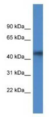 Western Blot: Agpat4 Antibody [NBP1-79870]