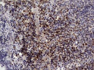 Immunohistochemistry: Aiolos/IKZF3 Antibody (OTI7E11) [NBP2-46048]
