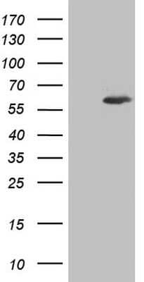 Western Blot: Aiolos/IKZF3 Antibody (OTI7E11) [NBP2-46048]