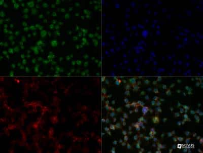 Immunocytochemistry/ Immunofluorescence: Aiolos/IKZF3 Antibody - BSA Free [NBP2-24495]