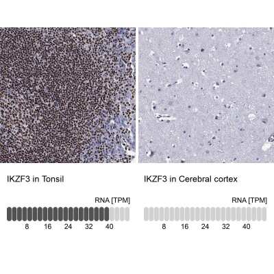 Immunocytochemistry/ Immunofluorescence: Aiolos/IKZF3 Antibody [NBP3-16978]