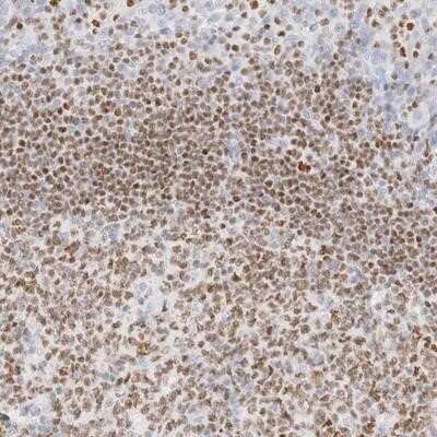 Immunohistochemistry-Paraffin: Aiolos/IKZF3 Antibody [NBP1-89185]