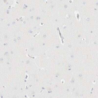 Immunohistochemistry-Paraffin: Aiolos/IKZF3 Antibody [NBP1-89185]