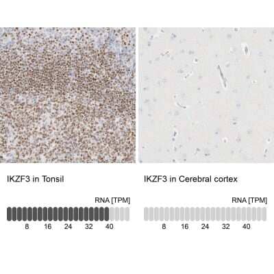 Immunohistochemistry-Paraffin: Aiolos/IKZF3 Antibody [NBP1-89185]