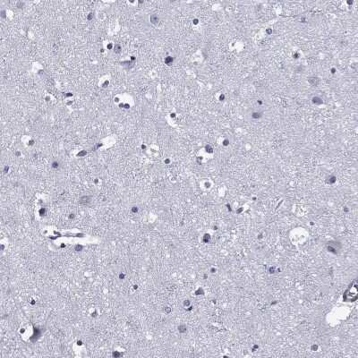 Immunohistochemistry-Paraffin: Aiolos/IKZF3 Antibody [NBP3-16978]