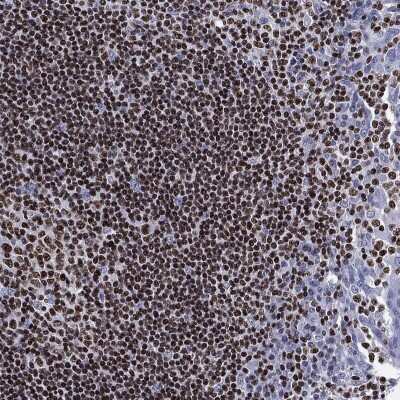 Immunohistochemistry-Paraffin: Aiolos/IKZF3 Antibody [NBP3-16978]