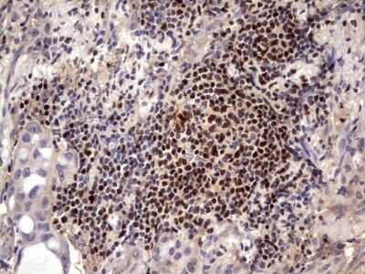 Immunohistochemistry: Aiolos/IKZF3 Antibody (OTI7E11) - Azide and BSA Free [NBP2-71698]