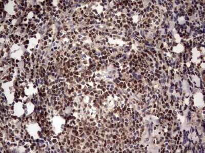 Immunohistochemistry: Aiolos/IKZF3 Antibody (OTI7E11) - Azide and BSA Free [NBP2-71698]