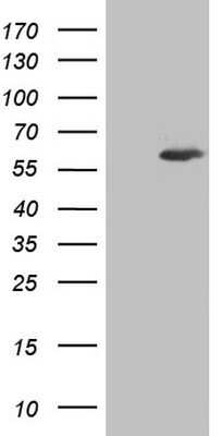 Western Blot: Aiolos/IKZF3 Antibody (OTI7E11)Azide and BSA Free [NBP2-71698]