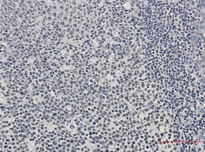 Immunohistochemistry-Paraffin: Aiolos/IKZF3 Antibody (S01-0C5) [NBP3-20069]