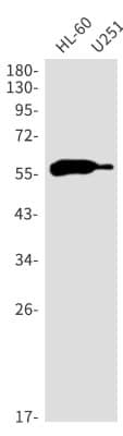 Western Blot: Aiolos/IKZF3 Antibody (S01-0C5) [NBP3-20069]