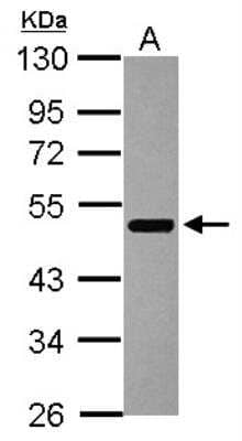 Western Blot: Aiolos/IKZF3 Antibody [NBP2-16938]