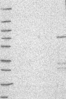 Western Blot: Aiolos/IKZF3 Antibody [NBP3-16978]