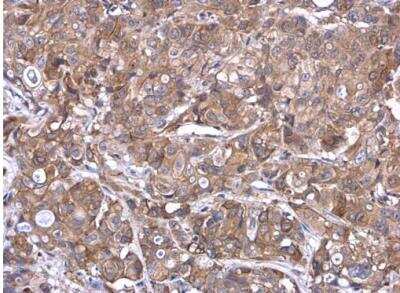 Immunohistochemistry-Paraffin: Airway Trypsin-like Protease/HAT/TMPRSS11D Antibody [NBP2-20668]