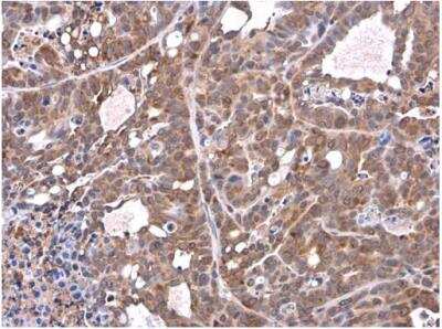 Immunohistochemistry-Paraffin: Airway Trypsin-like Protease/HAT/TMPRSS11D Antibody [NBP2-20668]