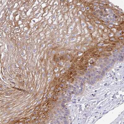 Immunohistochemistry-Paraffin: Airway Trypsin-like Protease/HAT/TMPRSS11D Antibody [NBP2-49065]